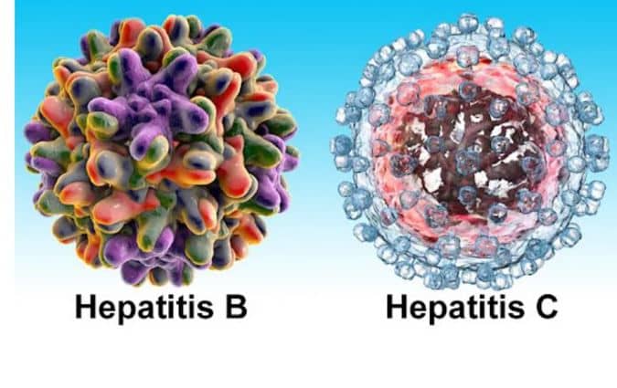 Discover How you can Overcome Hepatitis B, C, And Fatty  Liver Disease.