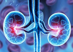 THE MOST EFFECTIVE WAY TO SOLVE KIDNEY DISEASE